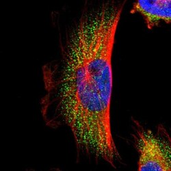 PARP14 Antibody, Novus Biologicals 0.1mL; Unlabeled:Antibodies, Polyclonal